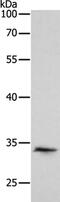 Ring Finger And CHY Zinc Finger Domain Containing 1 antibody, PA5-50251, Invitrogen Antibodies, Western Blot image 