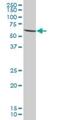 Phosphoglucomutase 5 antibody, H00005239-B01P, Novus Biologicals, Western Blot image 