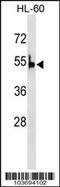 Pyruvate Kinase L/R antibody, 62-615, ProSci, Western Blot image 