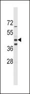 Aldehyde Dehydrogenase 1 Family Member A3 antibody, 63-240, ProSci, Western Blot image 