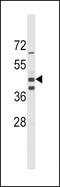 Aldehyde dehydrogenase family 1 member A3 antibody, 63-240, ProSci, Western Blot image 