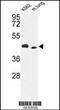 Inositol-Trisphosphate 3-Kinase A antibody, 63-441, ProSci, Western Blot image 