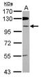 Zinc Finger Protein 512B antibody, NBP2-16692, Novus Biologicals, Western Blot image 