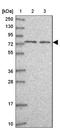 Tubulin Tyrosine Ligase Like 3 antibody, NBP2-13493, Novus Biologicals, Western Blot image 