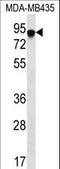 FYN Binding Protein 1 antibody, LS-C166292, Lifespan Biosciences, Western Blot image 