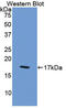 Coagulation Factor VIII antibody, LS-C302575, Lifespan Biosciences, Western Blot image 