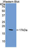 Coagulation Factor VIII antibody, LS-C302575, Lifespan Biosciences, Western Blot image 