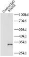 Stomatin antibody, FNab08344, FineTest, Immunoprecipitation image 