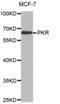 Eukaryotic Translation Initiation Factor 2 Alpha Kinase 2 antibody, abx002972, Abbexa, Western Blot image 