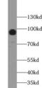 Mucin 16, Cell Surface Associated antibody, FNab05429, FineTest, Western Blot image 