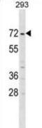 ZFP69 Zinc Finger Protein B antibody, abx030432, Abbexa, Western Blot image 