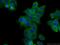 Trichoplein Keratin Filament Binding antibody, 25931-1-AP, Proteintech Group, Immunofluorescence image 