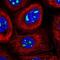 Nucleolar Protein Interacting With The FHA Domain Of MKI67 antibody, NBP2-48642, Novus Biologicals, Immunocytochemistry image 