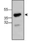 Syndecan 3 antibody, ab63932, Abcam, Western Blot image 