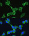 Triggering Receptor Expressed On Myeloid Cells 2 antibody, 13-679, ProSci, Immunofluorescence image 