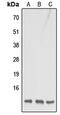 Cytochrome C Oxidase Subunit 7B antibody, GTX56091, GeneTex, Western Blot image 