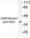 Protein Kinase AMP-Activated Non-Catalytic Subunit Beta 1 antibody, AP20874PU-N, Origene, Western Blot image 