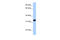 Acrosomal Vesicle Protein 1 antibody, 26-808, ProSci, Western Blot image 