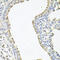 Sodium Channel Epithelial 1 Gamma Subunit antibody, 22-017, ProSci, Immunohistochemistry paraffin image 