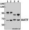 Apoptosis Antagonizing Transcription Factor antibody, A03945-1, Boster Biological Technology, Western Blot image 