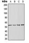 Actin Like 6A antibody, orb215996, Biorbyt, Western Blot image 
