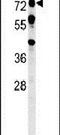 Olfactomedin Like 2A antibody, PA5-25706, Invitrogen Antibodies, Western Blot image 