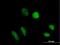 TruB Pseudouridine Synthase Family Member 1 antibody, H00142940-B01P, Novus Biologicals, Immunocytochemistry image 