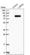 Leucine Rich Repeat Neuronal 2 antibody, NBP1-84686, Novus Biologicals, Western Blot image 