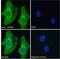 Integral Membrane Protein 2B antibody, NBP1-36963, Novus Biologicals, Immunocytochemistry image 