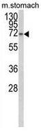 Transcription Elongation Regulator 1 Like antibody, GTX80965, GeneTex, Western Blot image 