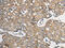 Protein Phosphatase 2 Catalytic Subunit Beta antibody, CSB-PA920060, Cusabio, Immunohistochemistry paraffin image 