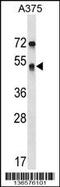 Septin 11 antibody, 58-753, ProSci, Western Blot image 