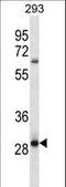 Melanocortin 2 Receptor Accessory Protein 2 antibody, LS-C164619, Lifespan Biosciences, Western Blot image 