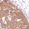 Unconventional prefoldin RPB5 interactor antibody, MBS303066, MyBioSource, Immunohistochemistry frozen image 