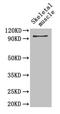 Glycogen Phosphorylase B antibody, LS-C211959, Lifespan Biosciences, Western Blot image 