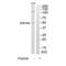 Zinc Finger Protein 446 antibody, A14684, Boster Biological Technology, Western Blot image 