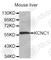Potassium Voltage-Gated Channel Subfamily C Member 1 antibody, A2995, ABclonal Technology, Western Blot image 