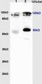 RE1 Silencing Transcription Factor antibody, GTX37363, GeneTex, Western Blot image 