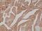 Kallikrein Related Peptidase 3 antibody, M01505-2, Boster Biological Technology, Immunohistochemistry frozen image 
