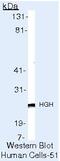 Growth Hormone 1 antibody, MA5-11926, Invitrogen Antibodies, Western Blot image 