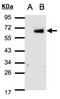 Interferon Regulatory Factor 6 antibody, NBP2-16990, Novus Biologicals, Western Blot image 