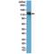 Melanoma Cell Adhesion Molecule antibody, M01683-2, Boster Biological Technology, Western Blot image 