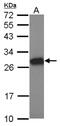 Testis Expressed Metallothionein Like Protein antibody, NBP2-20600, Novus Biologicals, Western Blot image 
