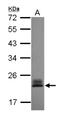 Ras Homolog Family Member C antibody, NBP2-20156, Novus Biologicals, Western Blot image 