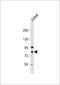 Rho GTPase Activating Protein 25 antibody, 61-689, ProSci, Western Blot image 