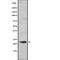 Calcyon Neuron Specific Vesicular Protein antibody, abx148842, Abbexa, Western Blot image 