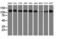 Histone Deacetylase 6 antibody, LS-C115826, Lifespan Biosciences, Western Blot image 
