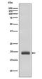Caveolin 3 antibody, M00990, Boster Biological Technology, Western Blot image 
