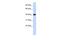 Nuclear Receptor Subfamily 2 Group E Member 1 antibody, PA5-40484, Invitrogen Antibodies, Western Blot image 