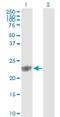 Glutathione S-Transferase Pi 1 antibody, H00002950-M01, Novus Biologicals, Western Blot image 